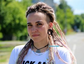 Ганцевчанка с необычной внешностью рассказала, легко ли быть не такой, как все